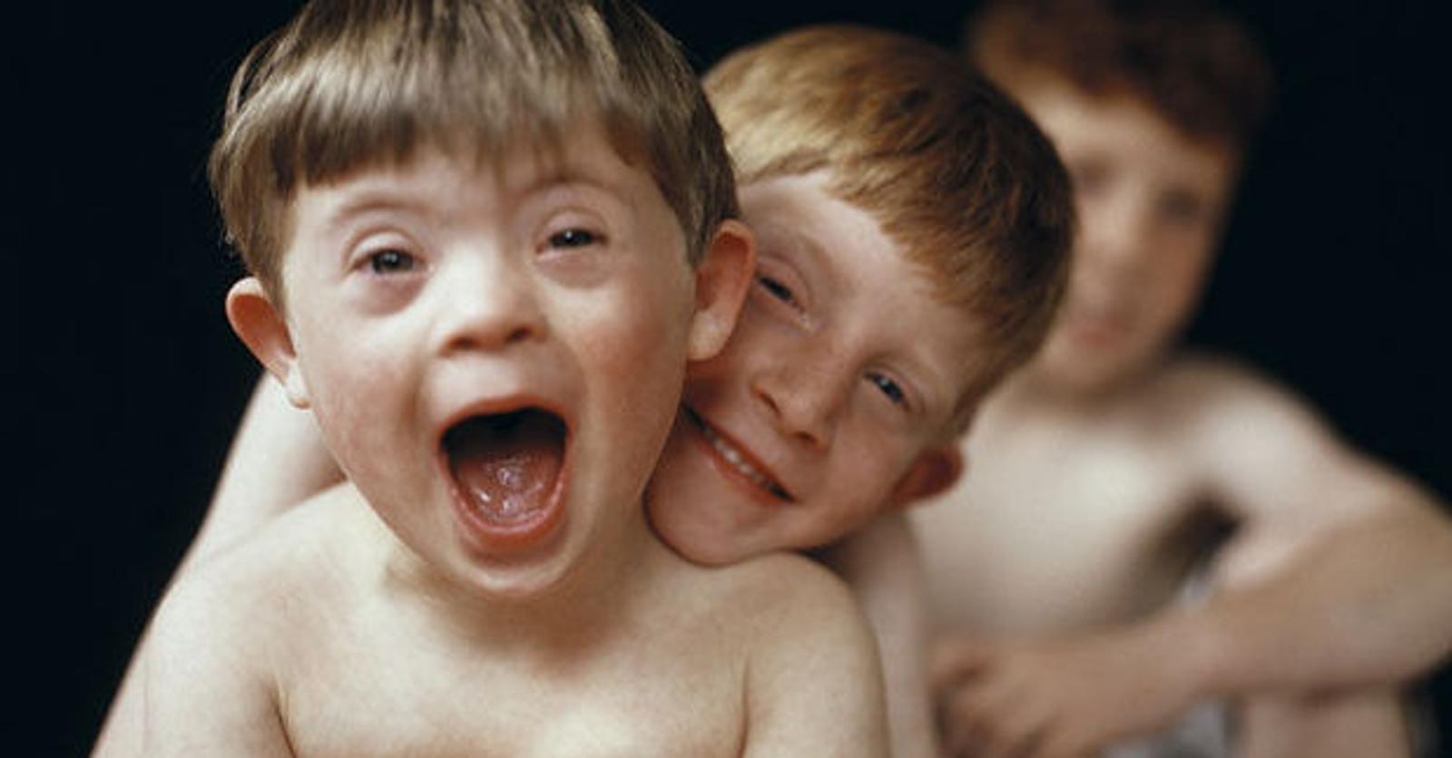 Geboortes van kinderen met het syndroom van Down stijgt