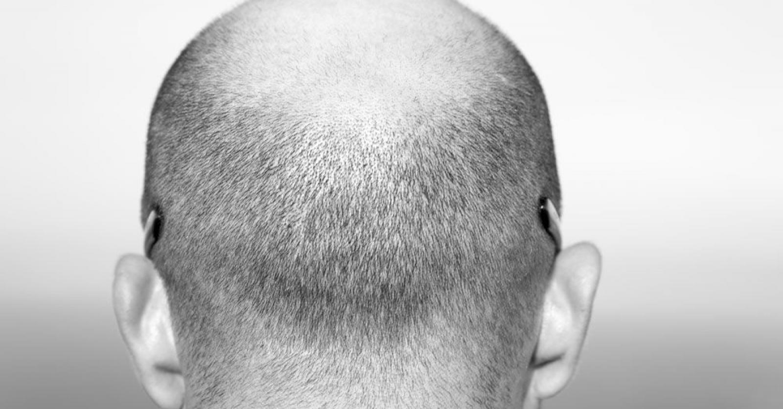 'Wat ben je met haar op je tanden als je krampachtig naar haar op je