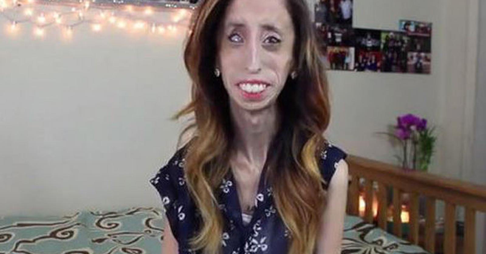 Vidéo: Lizzie Velasquez, 