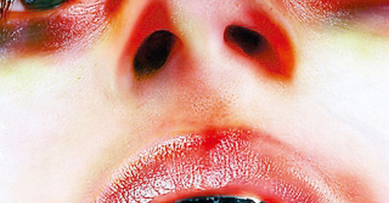 Arca
