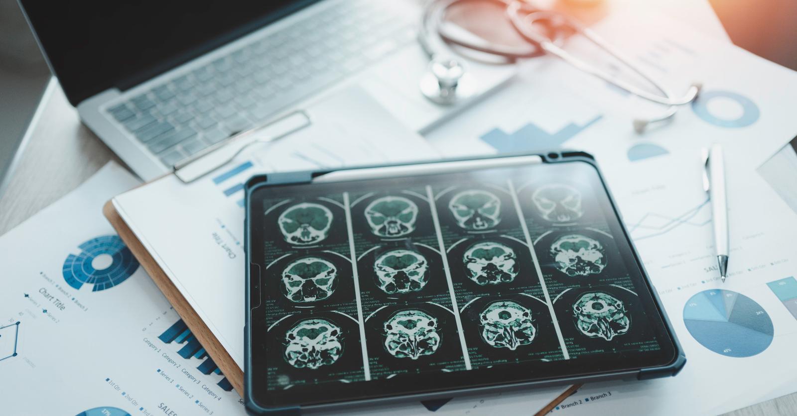 "Rajeunir" le cerveau pour lutter contre la maladie d'Alzheimer - Plus ...