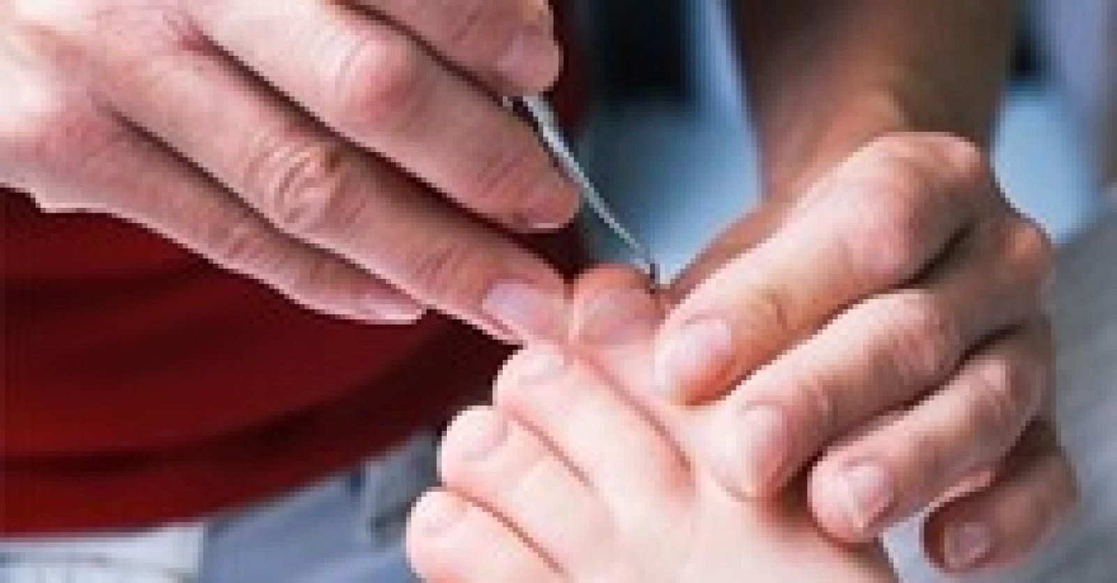 Un ongle incarné - Plus Magazine