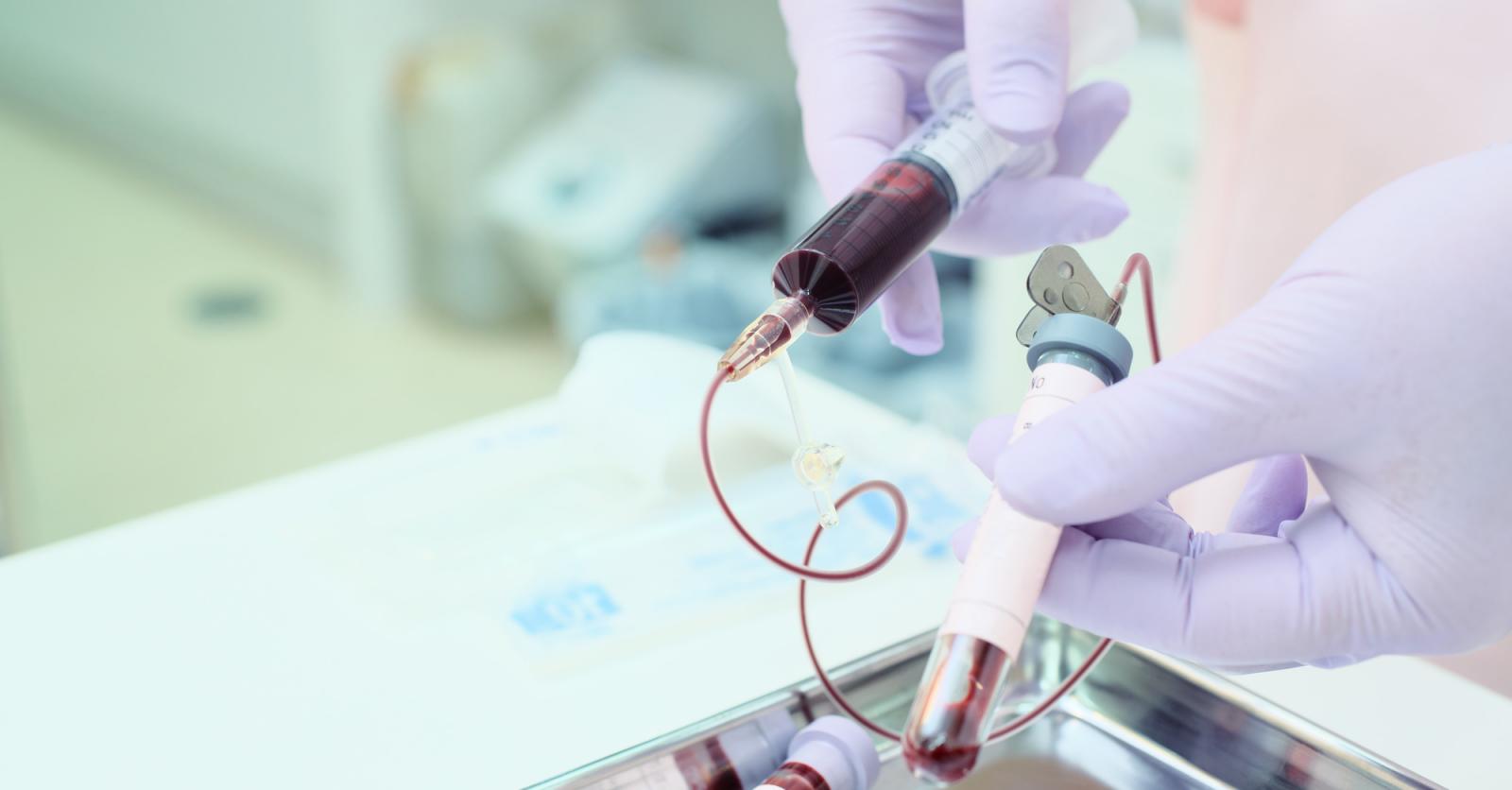 La prise de sang, toujours à jeun Plus Magazine