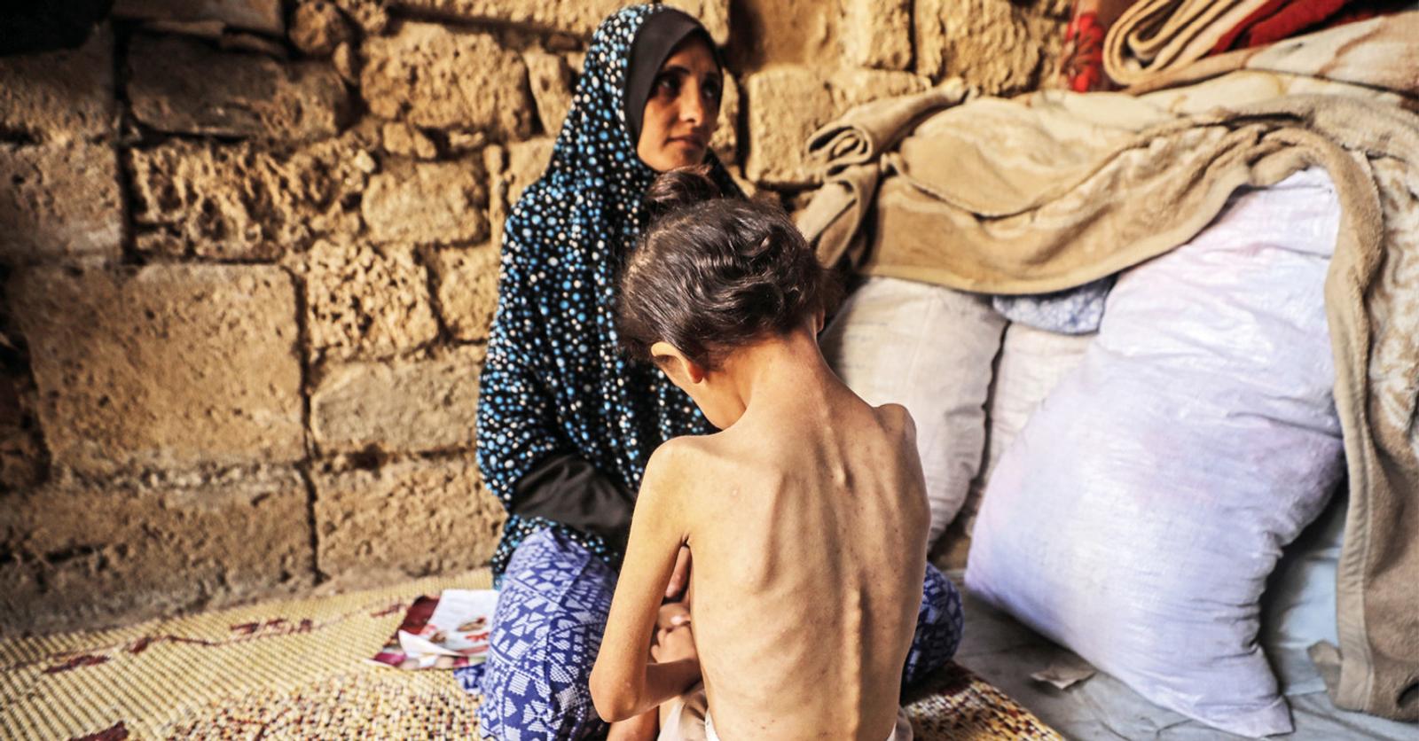 Gaza Guerre à Gaza: la faim, l’insupportable arme de guerre d’Israël