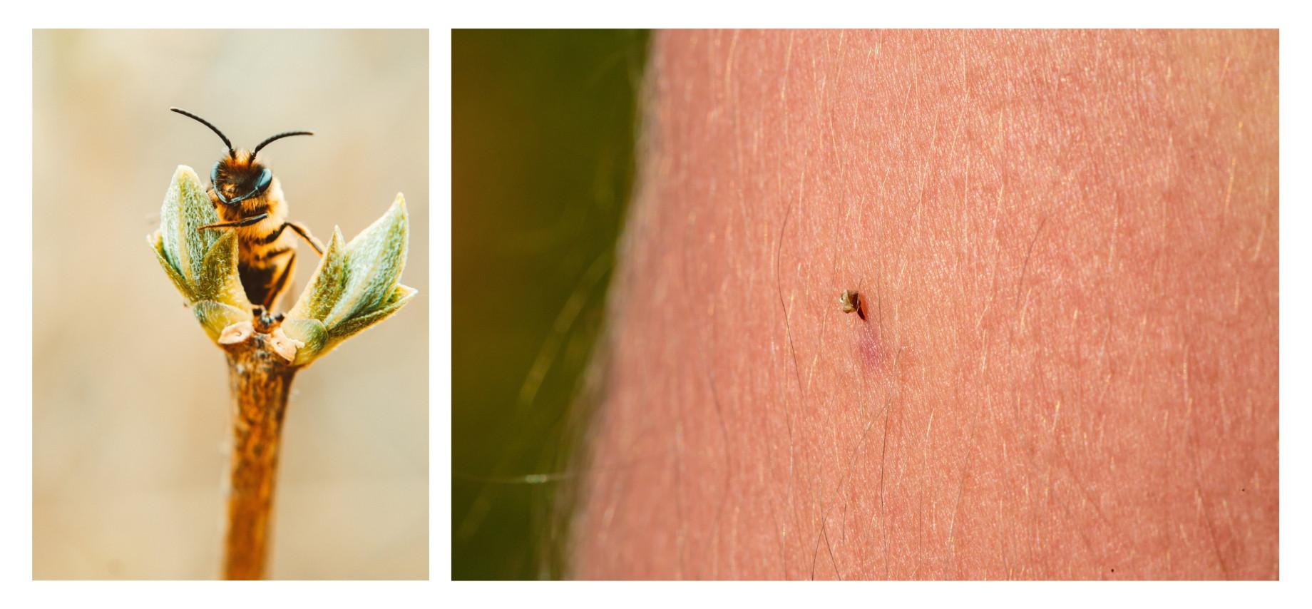 Que faire en cas de piqûre d'abeille