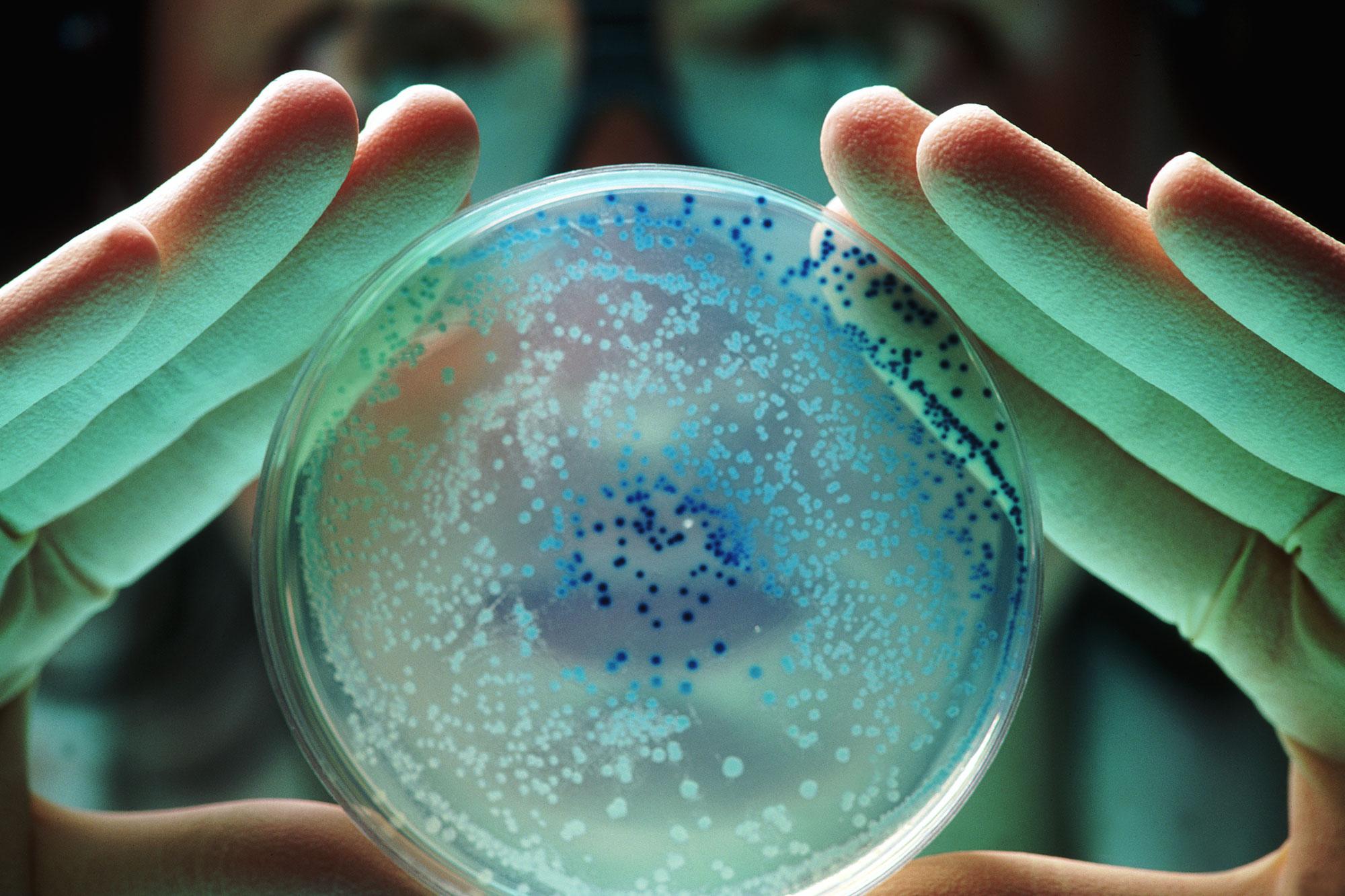 Nieuwe antibiotica met behulp van AI kan superbacterie doden