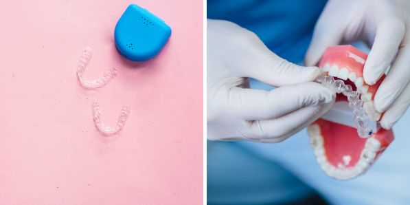 raitement Invisalign Easy Line DR Flair Getty Images