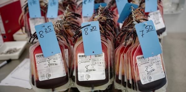 plasma