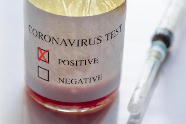 Het coronavirus grijpt wild om zich heen in Ter Verte.© Getty Images