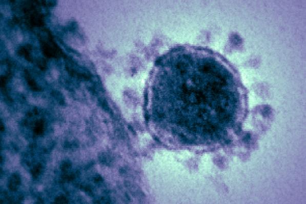 Beurzen Vandaag: lagere koersen door coronavirus, koopadvies IMCD