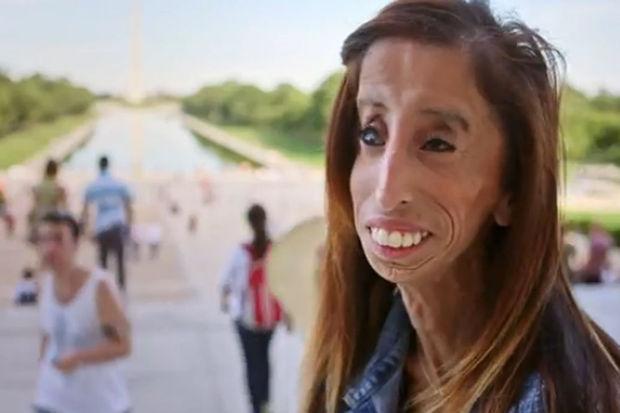 La Plus Moche Femme Du Monde Entier Lizzie Velasquez, "femme la plus moche du monde", signe un documentaire