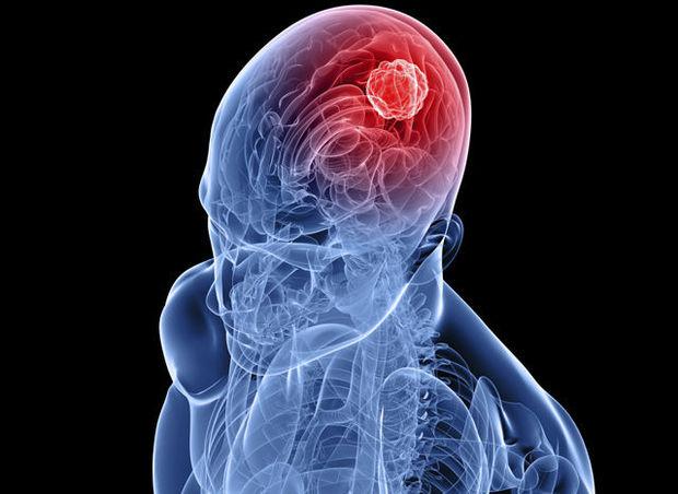 Merck et SanofiAventis union sacrée contre le cancer TrendsTendances