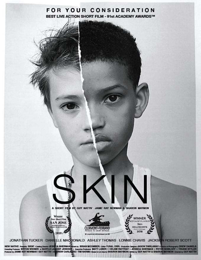 Beste kortfilm: Skin