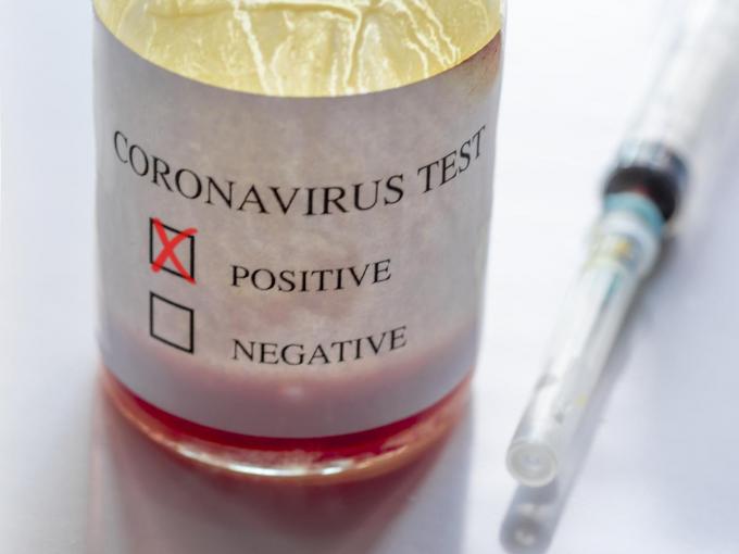 Het coronavirus grijpt wild om zich heen in Ter Verte.© Getty Images