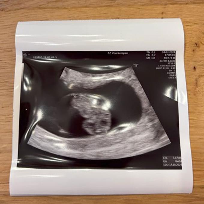 Eerste echo