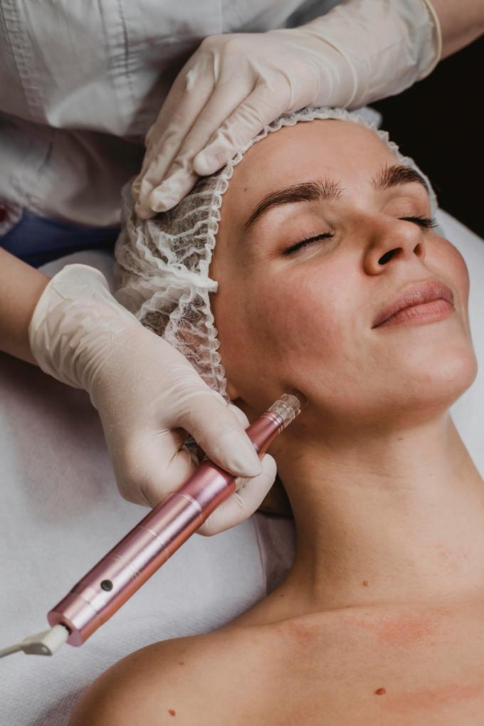 Notre journaliste beauté a testé le microneedling - Canva