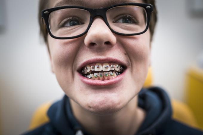 Maximaal 792 euro per jaar voor een beugel of blok
