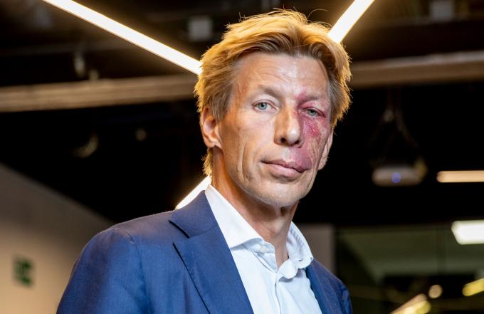 Chris Peeters (bpost), sur la grève historique: “L’impact est très négatif, le trajet sans plan social sera moins facile”