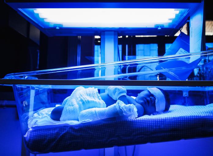 Baby Suffering From Jaundice Lying Under Ultraviolet Light In Incubator geelzucht