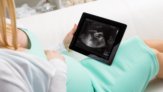 Bebe Est Il Droitier Ou Gaucher Vous Pouvez Le Decouvrir Pendant La Grossesse Femmes D Aujourd Hui Mamans