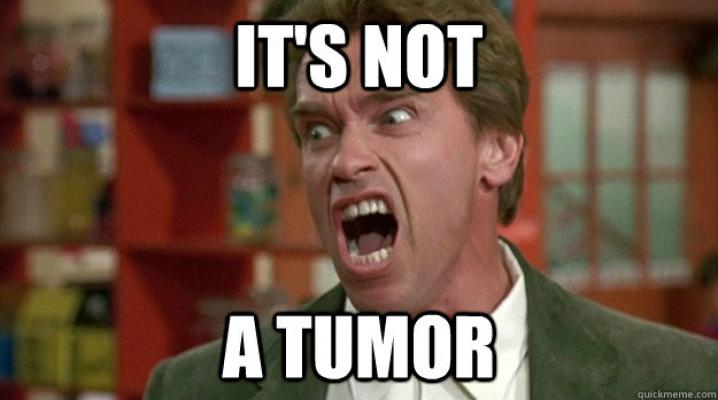 no tumor