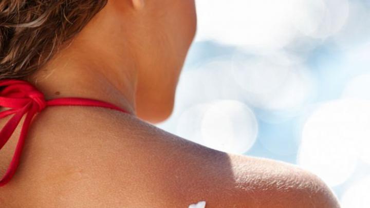 5 conseils pour prévenir le cancer de la peau 5 conseils pour prévenir le cancer de la peau
