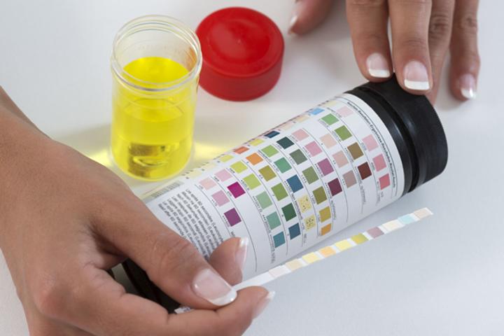 Wat de kleur van je urine zegt over je gezondheid