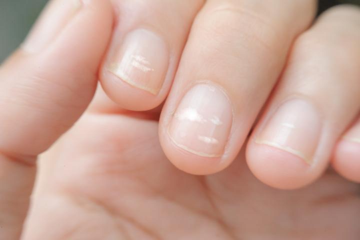 AHA: dit betekenen die witte vlekken op je nagels (en zo kom je er vanaf)