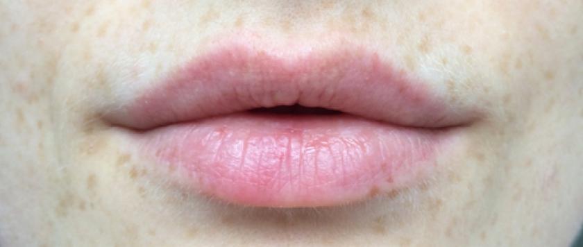 Libelle Test Uit Groene Lippenbalsem Die Van Kleur Verandert Libelle