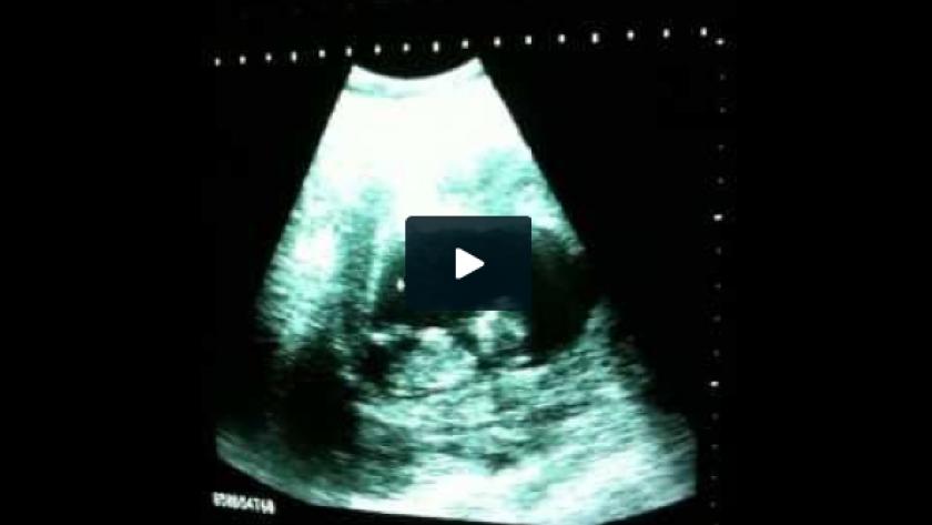 Video Bebe Hyperactif Dans Le Ventre De Sa Maman Femmes D Aujourd Hui