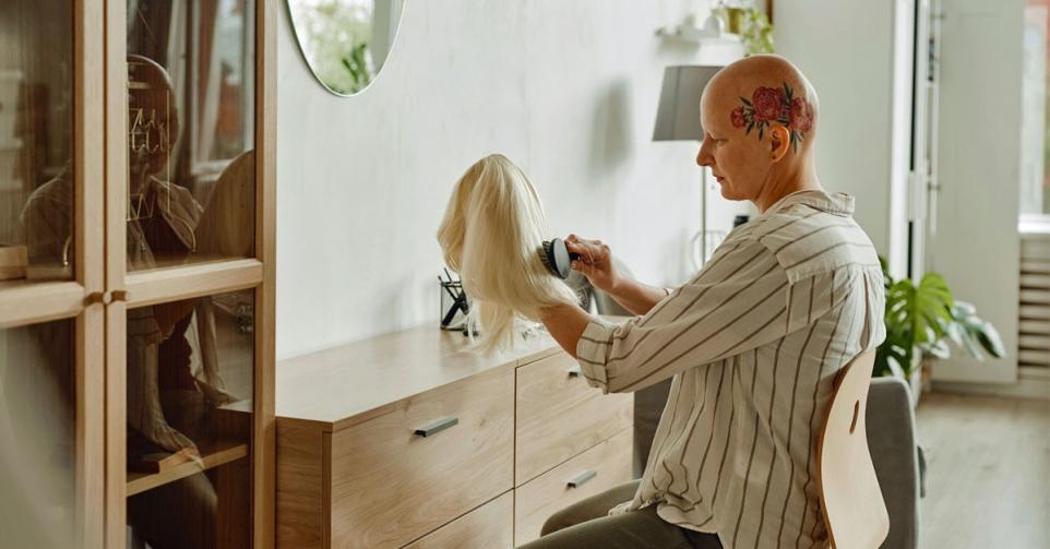alopecia