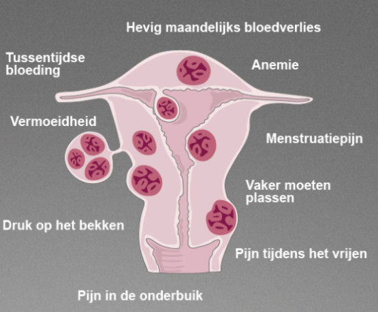 Veel Pijn Tijdens Je Menstruatie Dit Zou De Oorzaak Kunnen Zijn Flair Be